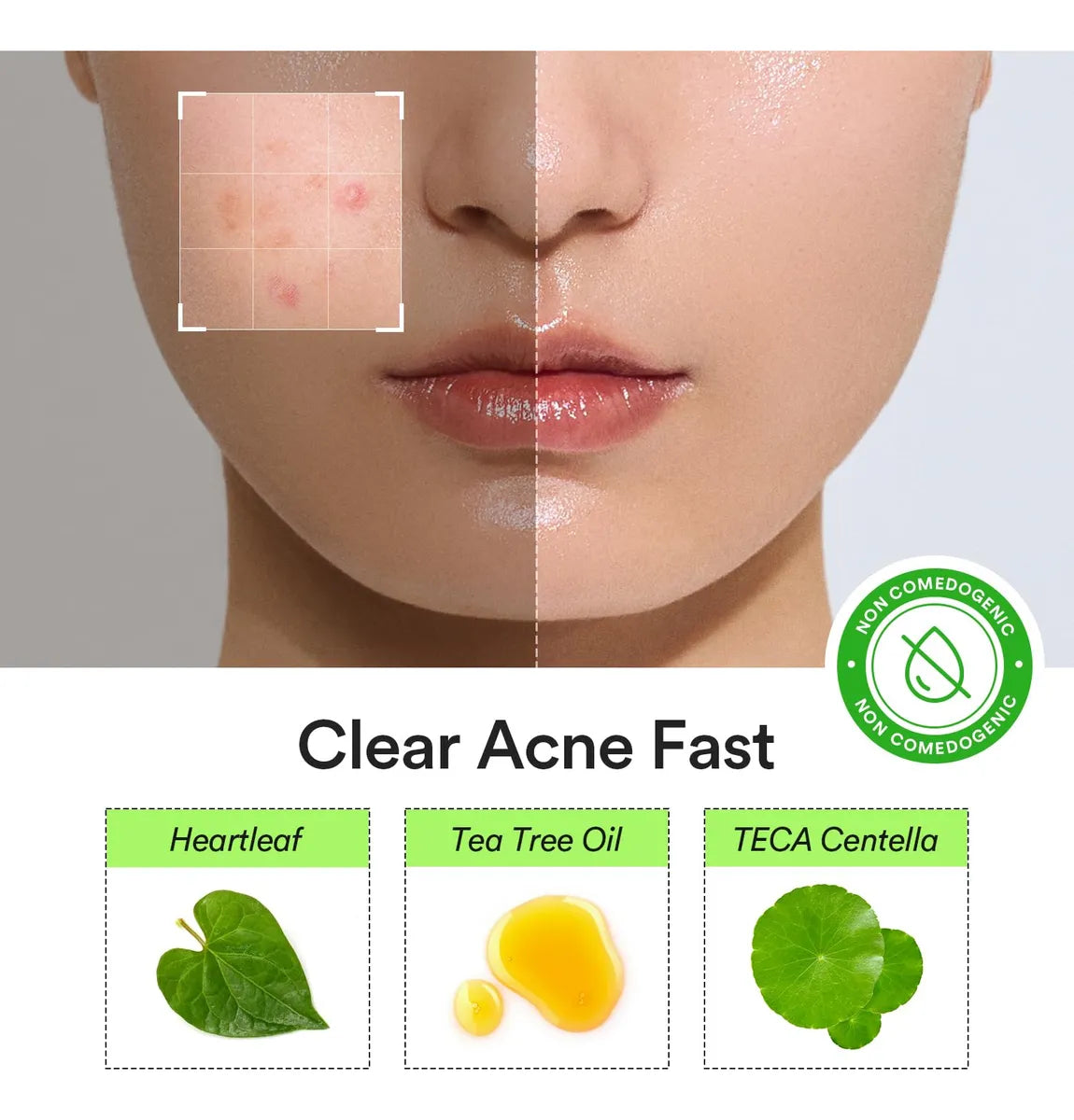 ABIB - Heartleaf Calming Spot Patch 78pcs