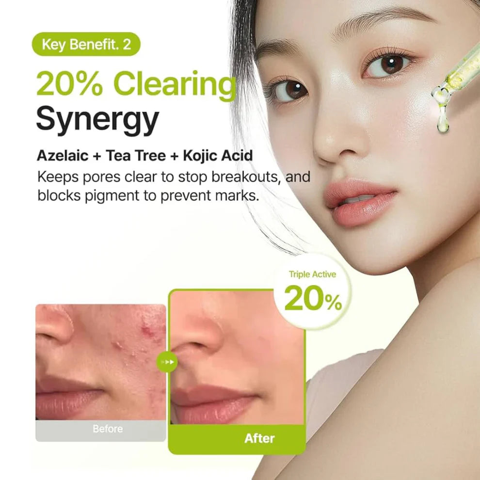 Purito Azelaic Acid 10% Kojic Tea Tree Serum (30 ml)